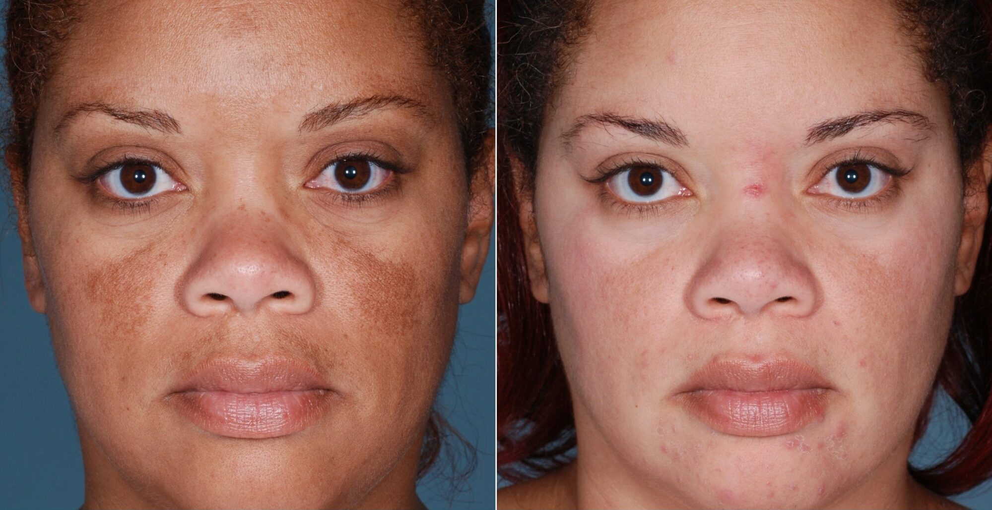 antes-e-depois-meu-queridinho-e1657127435722.jpg